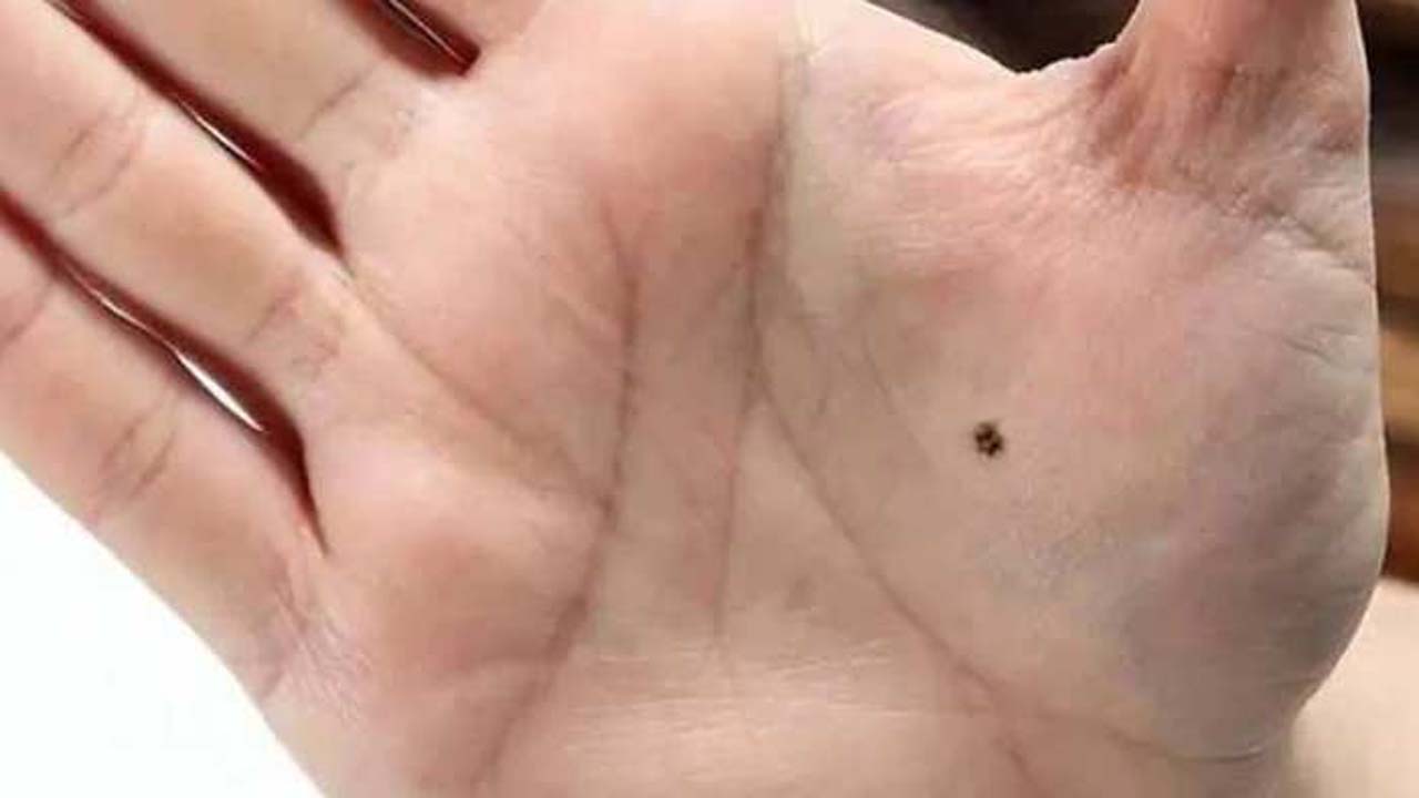 Mole