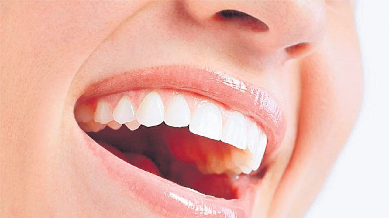 Bleeding Gums