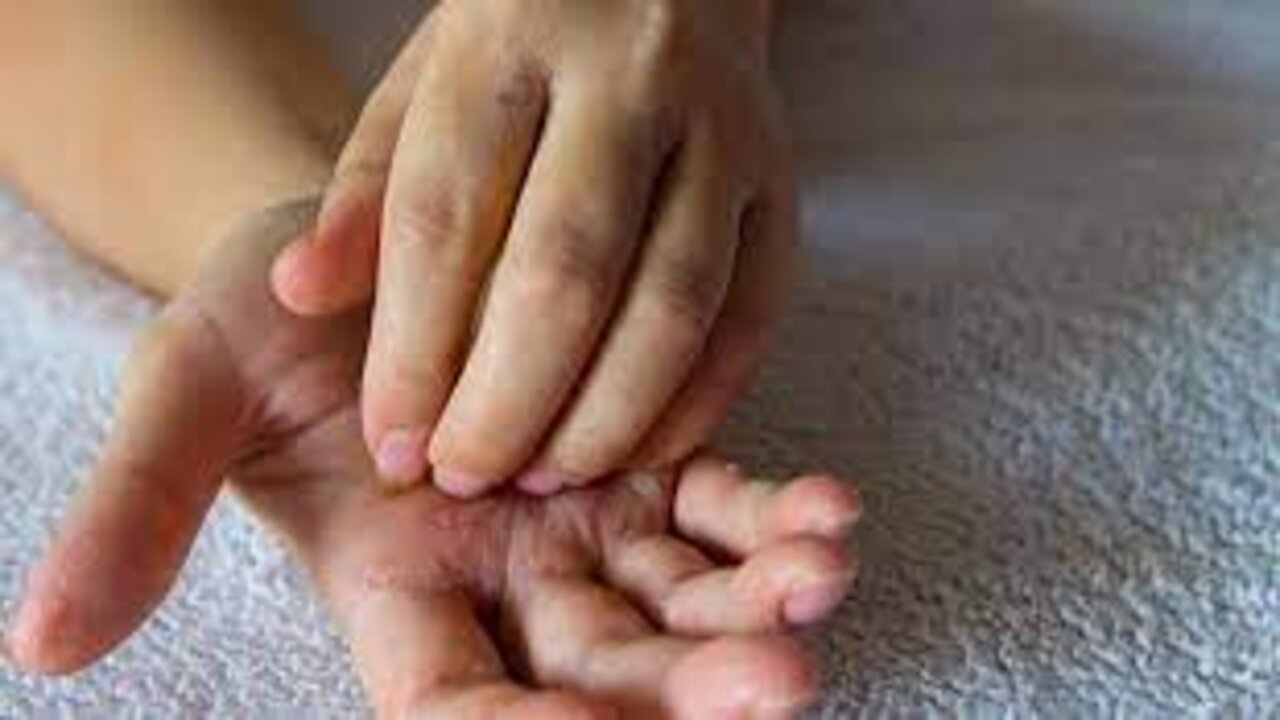 Hands