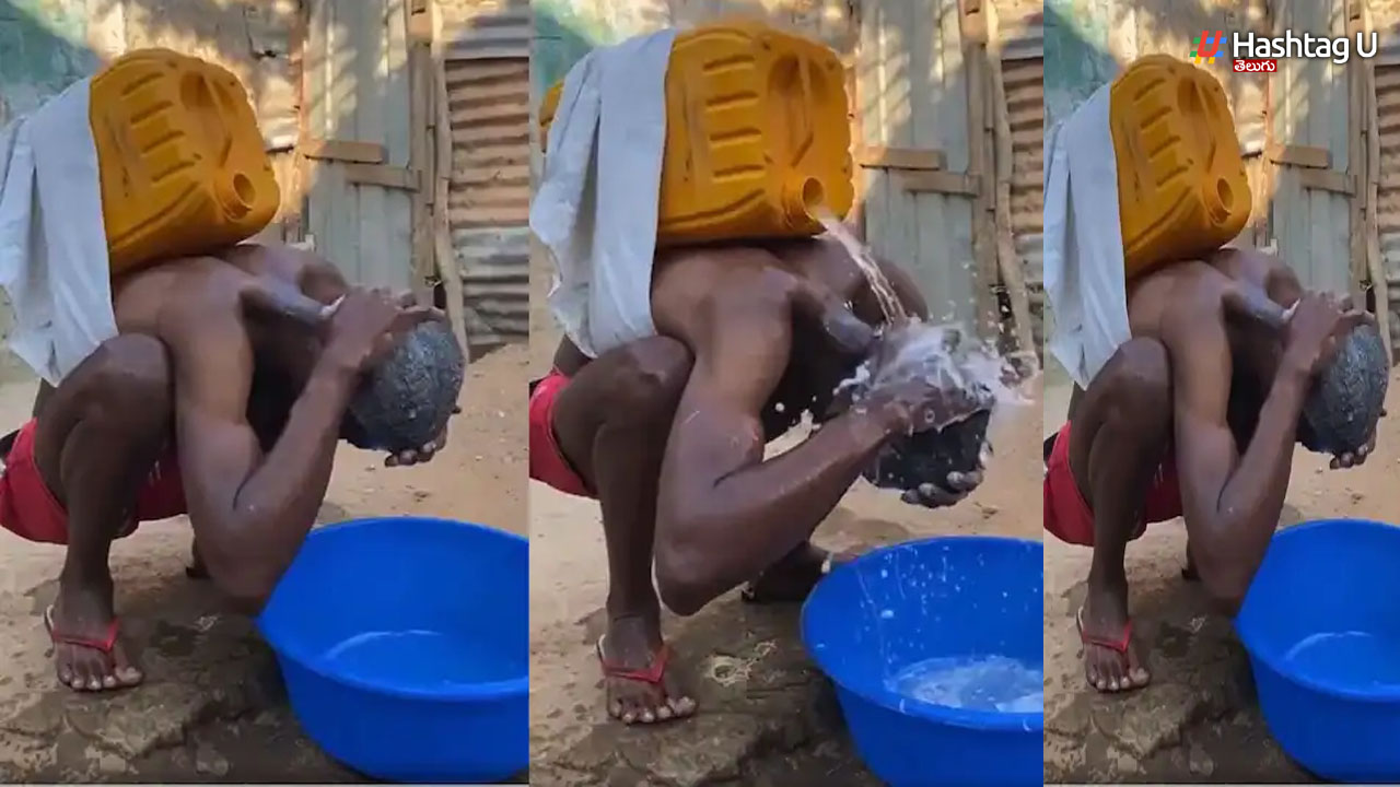 Viral