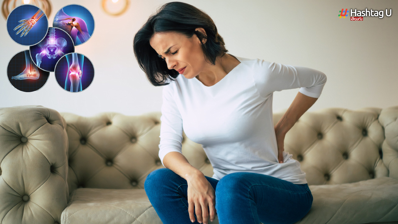 Arthritis NCBI