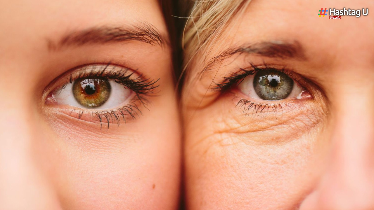 Wrinkles And Fine Lines On Face In Young Age
