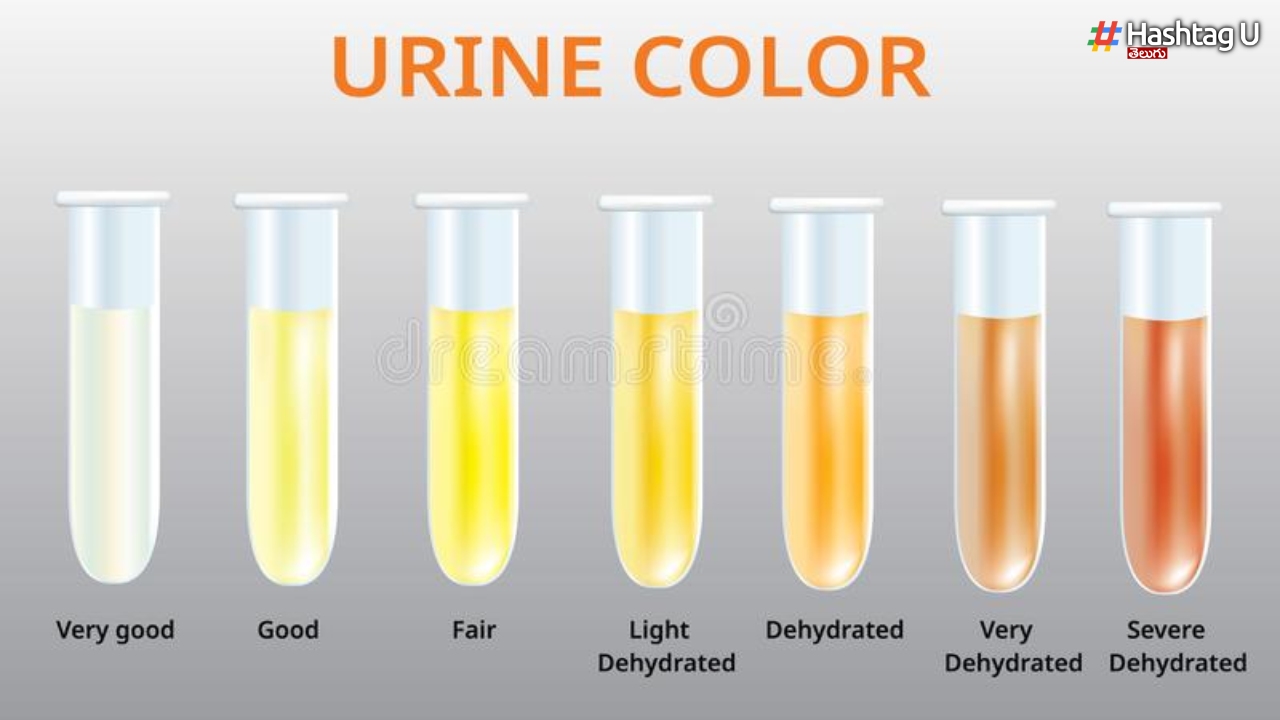 Do You Know What Happens If The Color Of The Urine Changes 