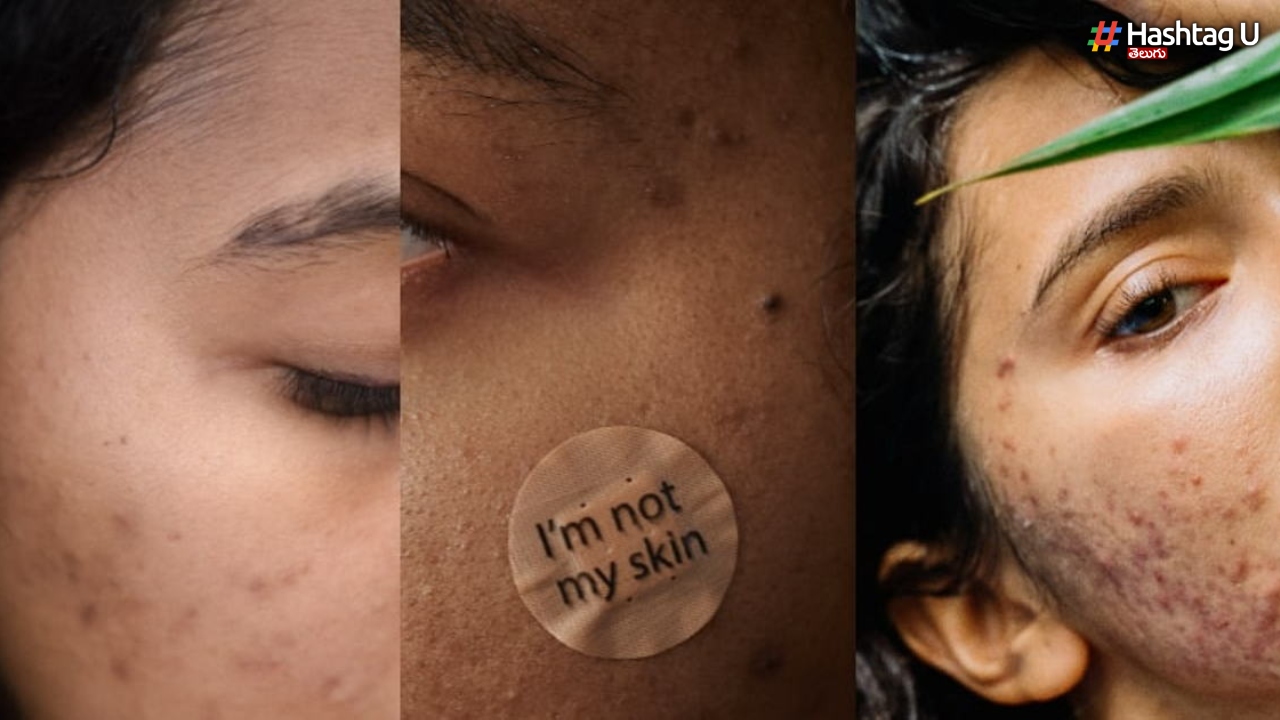 Got Sensitive Skin Try Avoiding These Skincare Ingredients In Your Routine