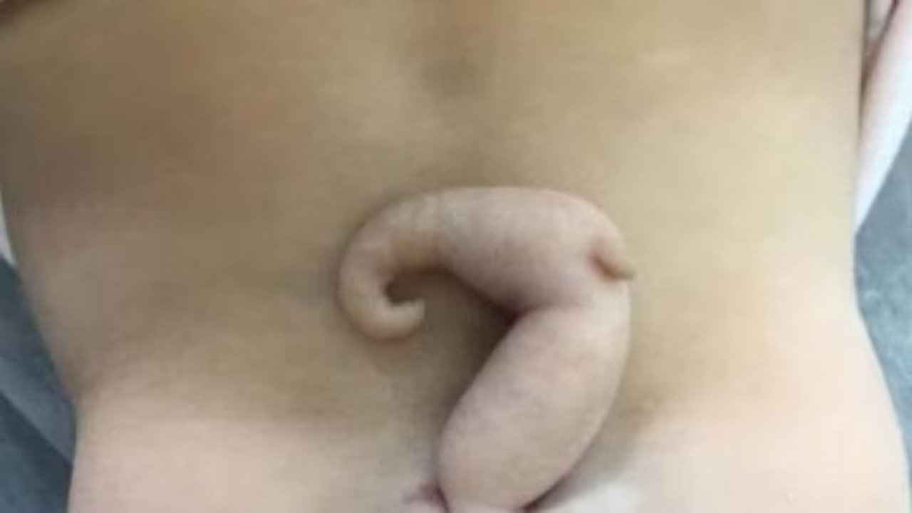 Tail