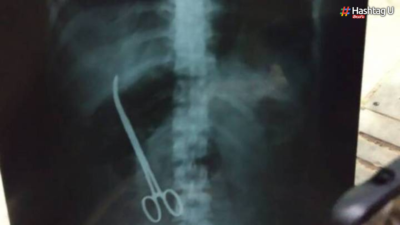 The Doctors Forgot The Scissors In The Stomach.. The Woman Has Been Living In Hell For Six Years (1)