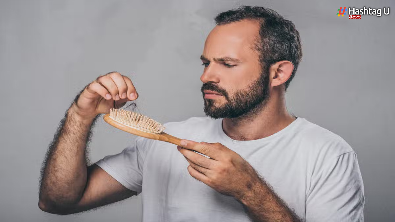 How To Overcome From Baldness..