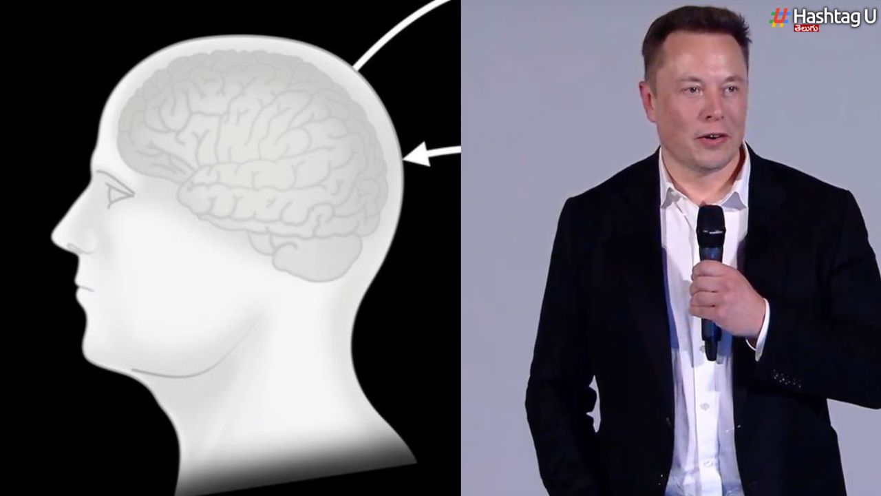 Chip In Brain