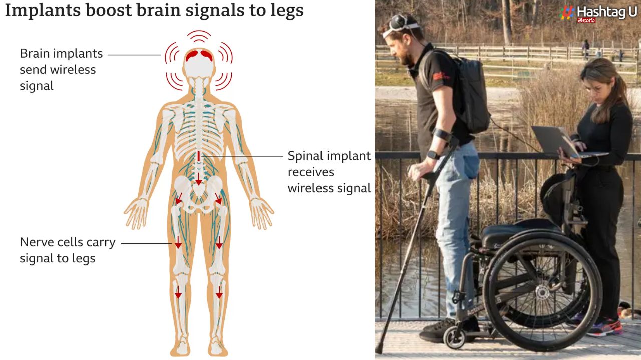 Victory On Paralysis