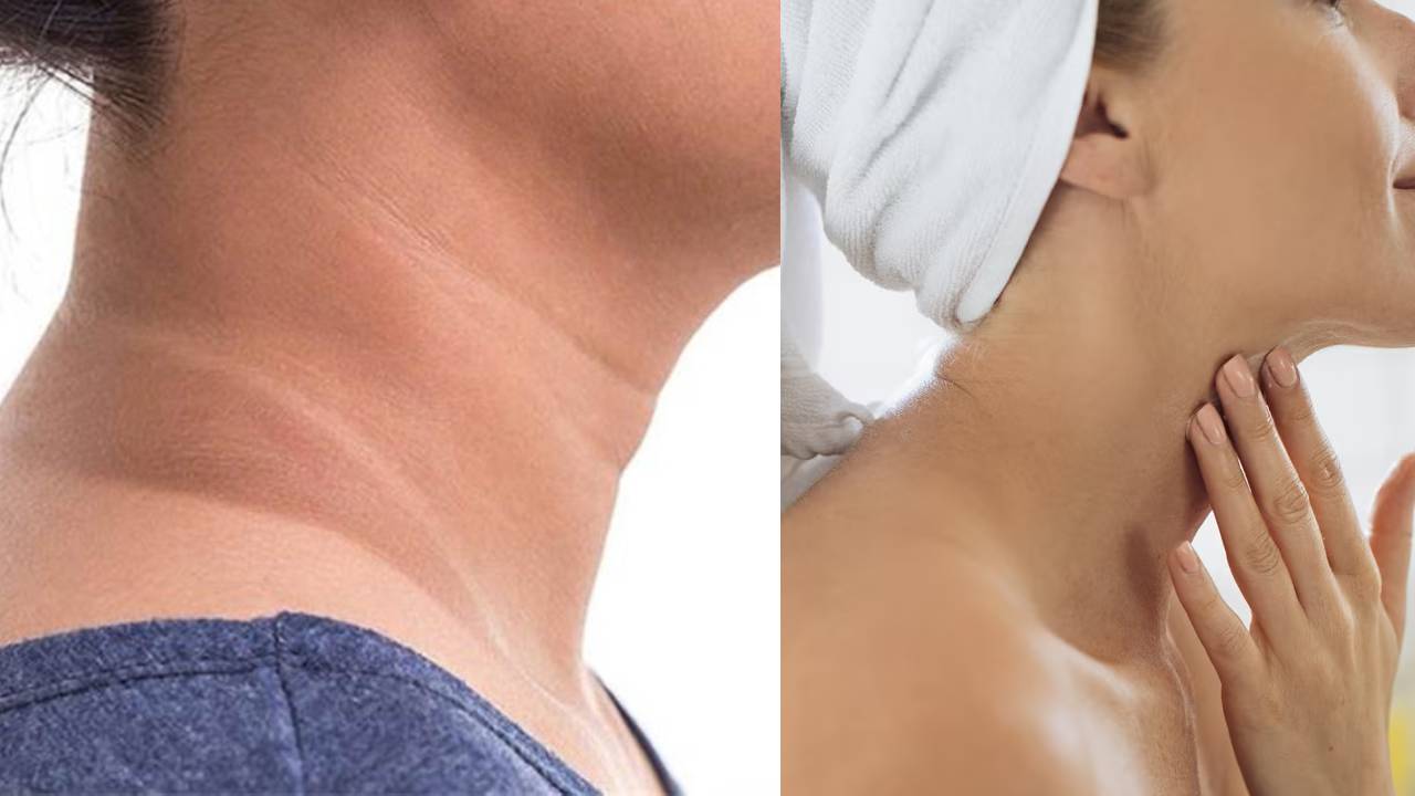 How to Remove Black marks on Neck with Home Tips