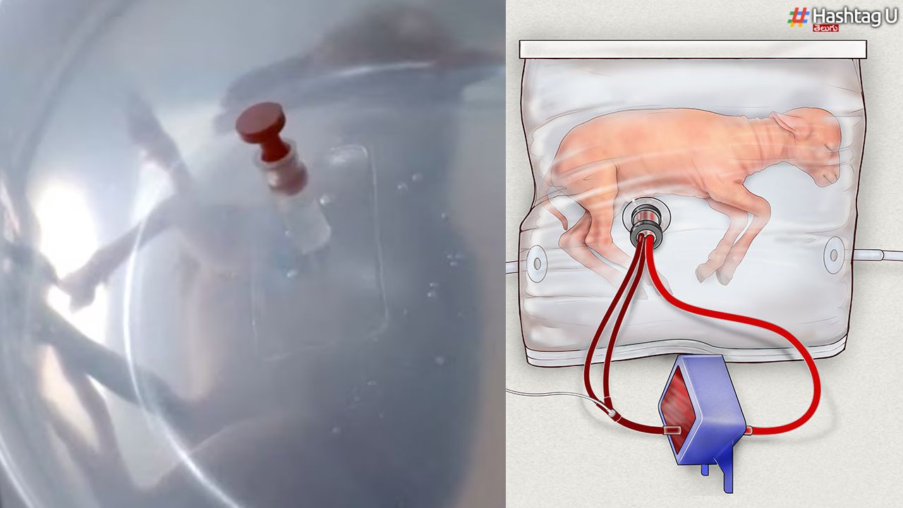 Artificial Womb