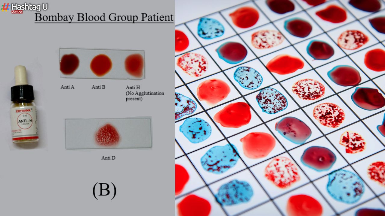 Bombay Blood Group