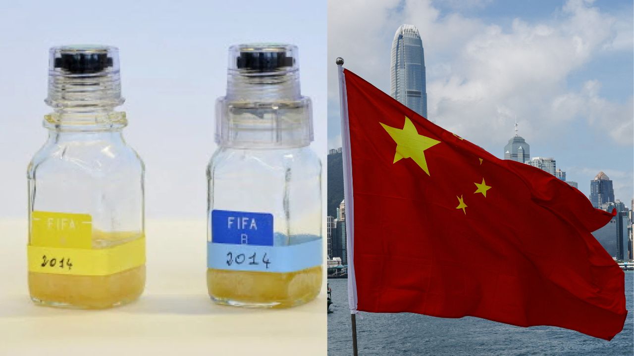 China Urine Business