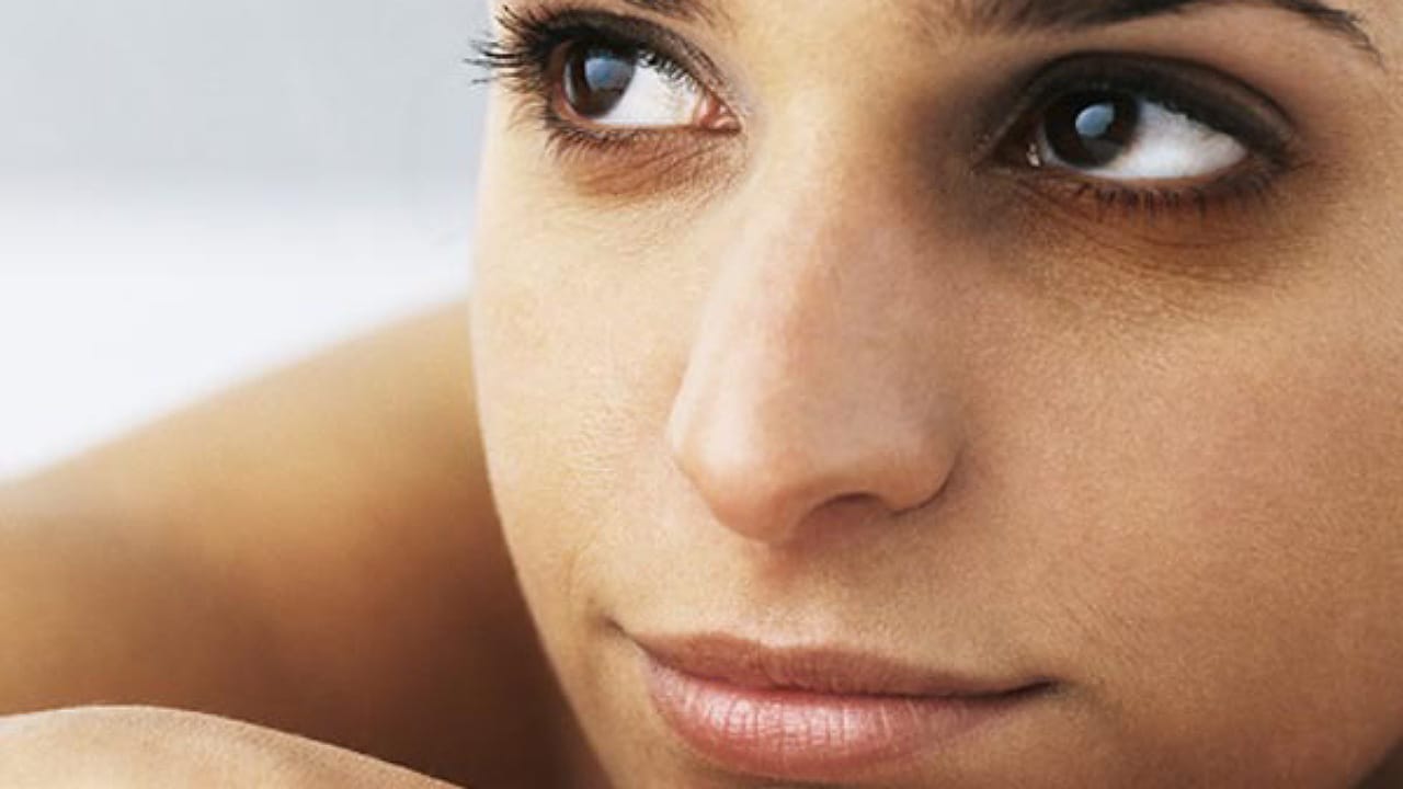 Dark Circles