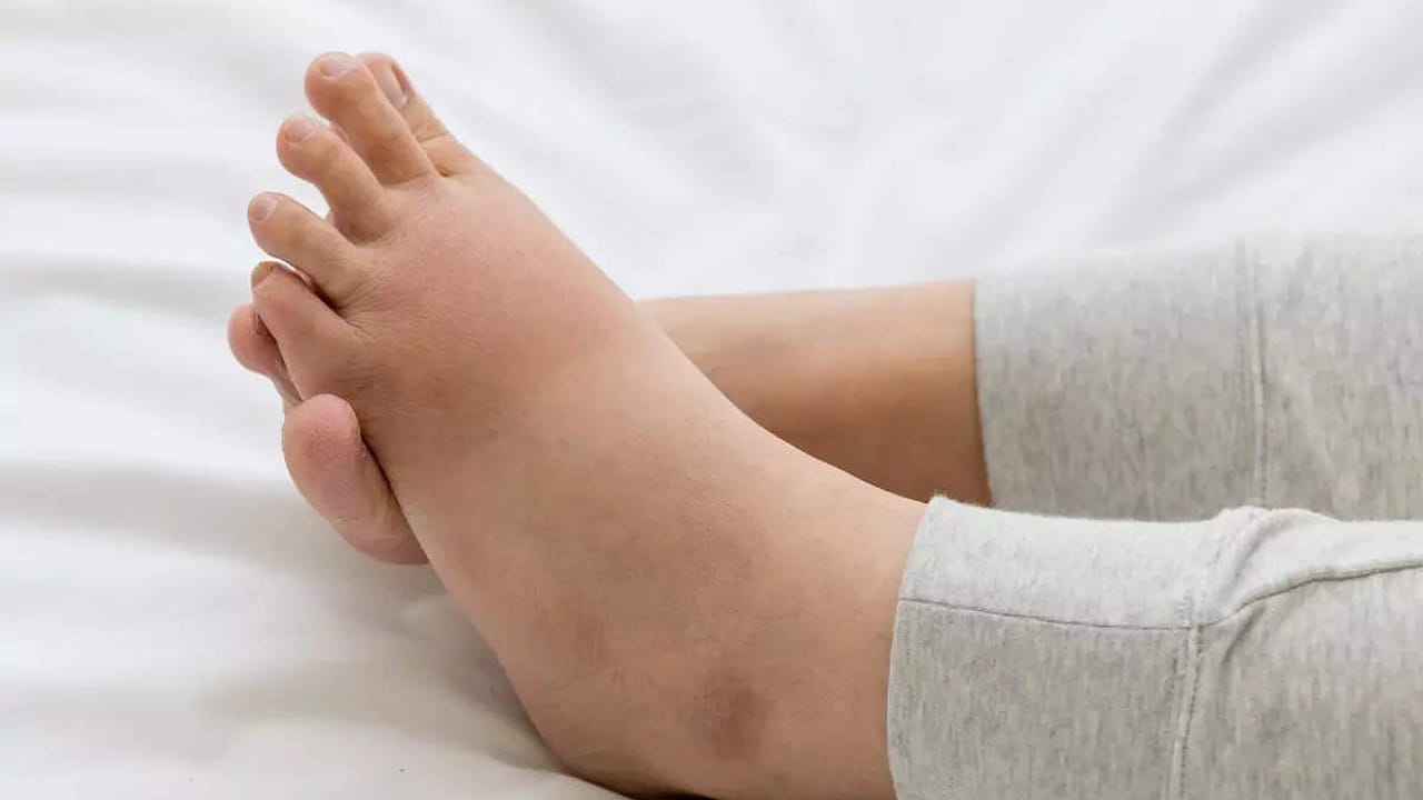 Feet Warning Symptoms