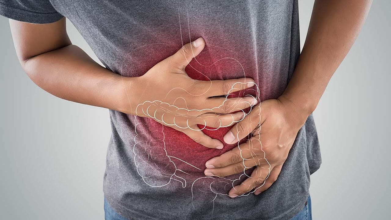Loose Motions Remedies