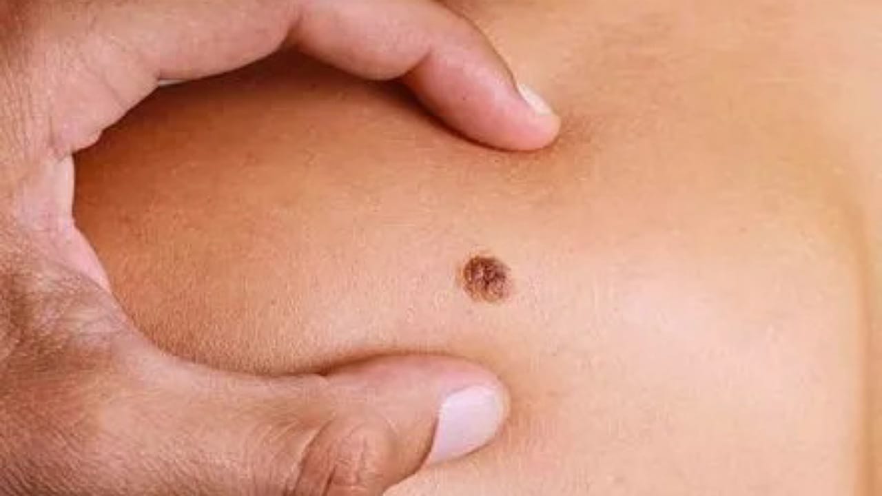 Symptoms Of Cancer