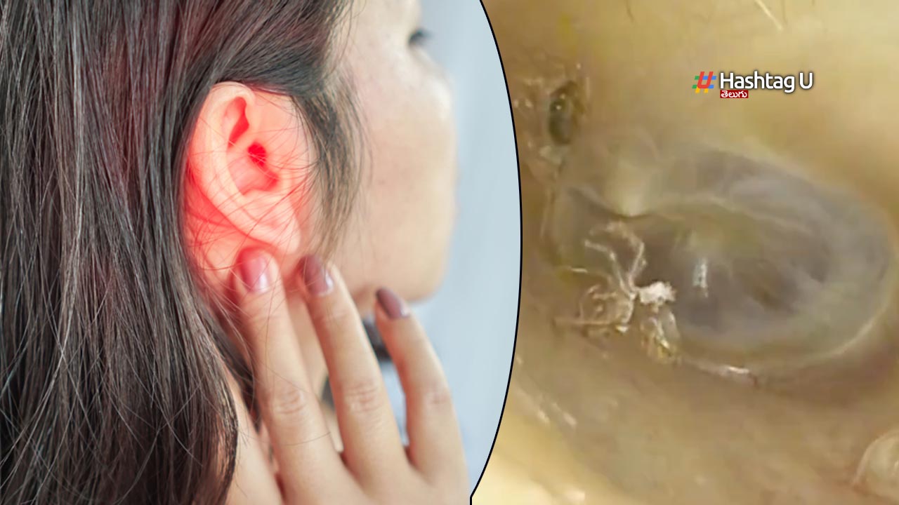 Spider Was Found Inside A Woman's Ear