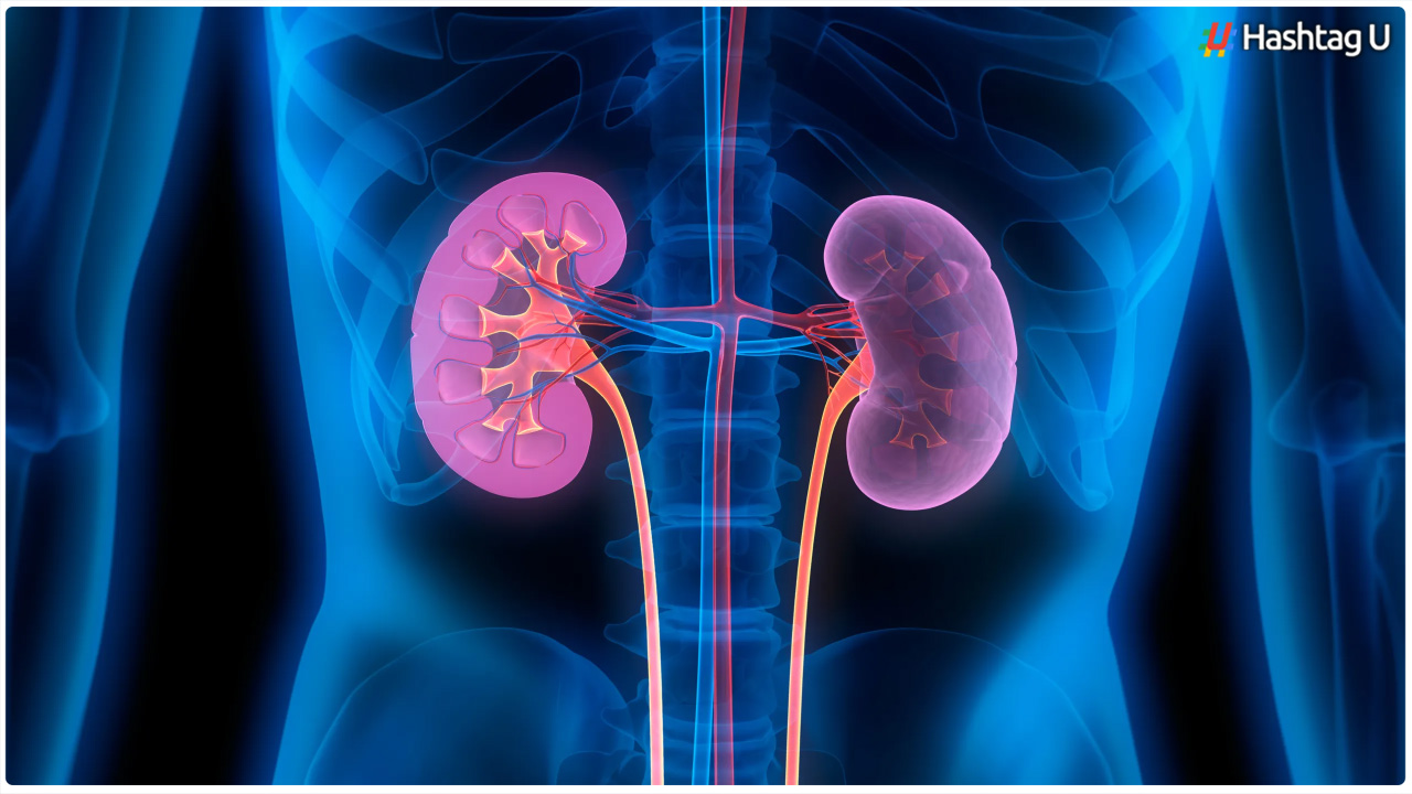 Are You Suffering From Kidney Stone Problem.. But Don't Do These 6 Mistakes At All..