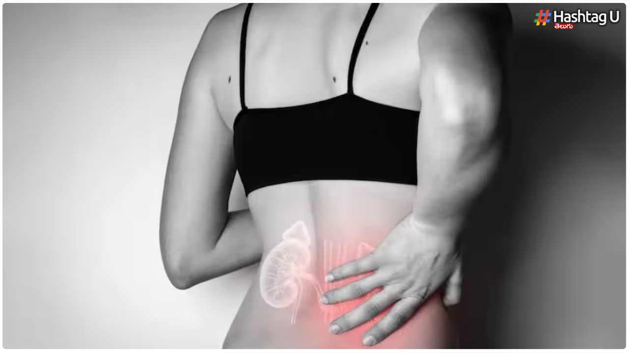 Kidney Stones
