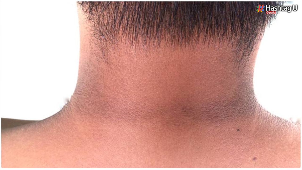 If You Follow These Beauty Tips, No Matter How Dark The Neck Becomes White..