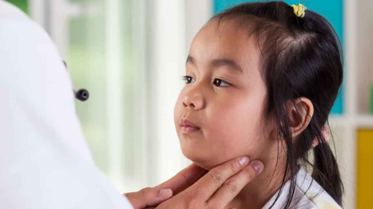 Mumps Outbreak