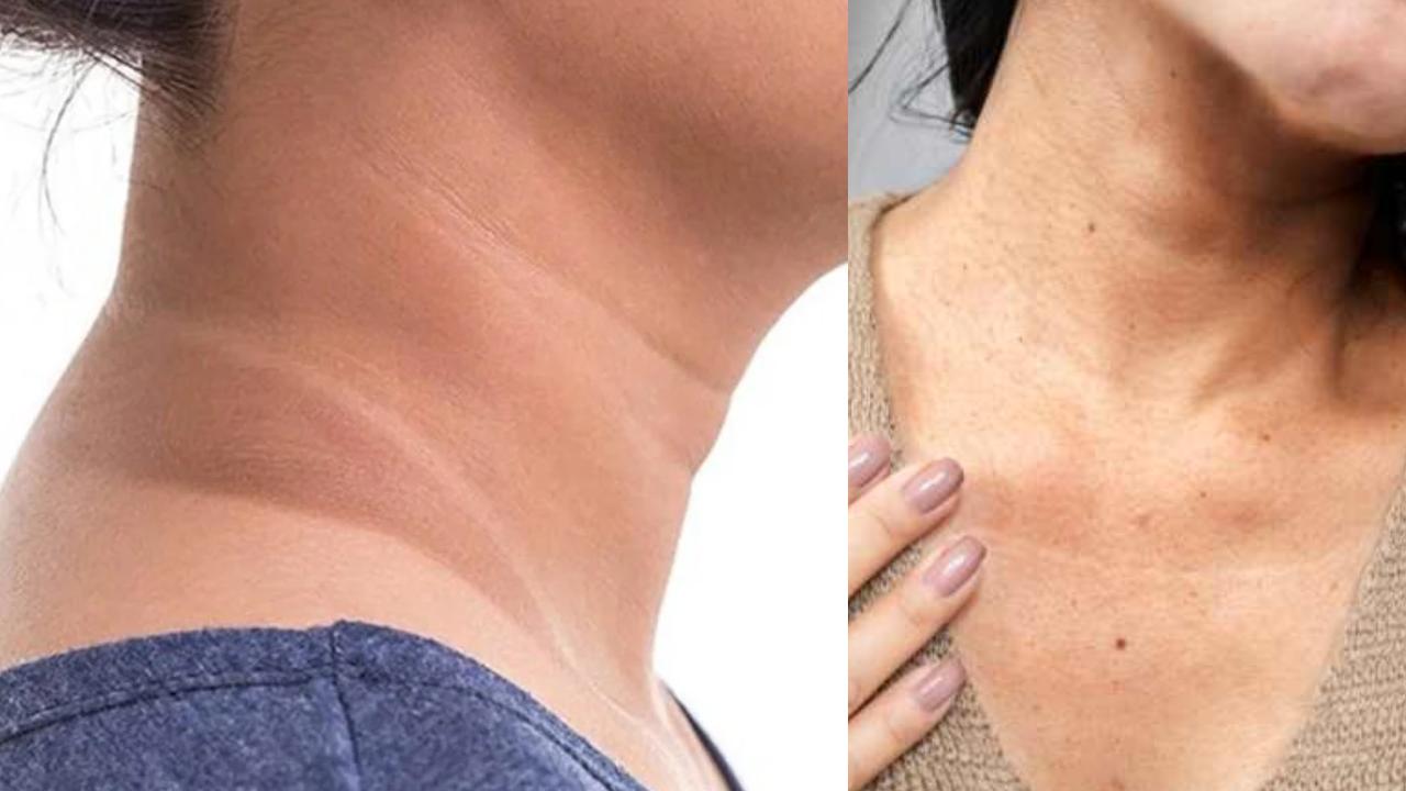 How to Reduce Darkness on Neck follow these Remedies