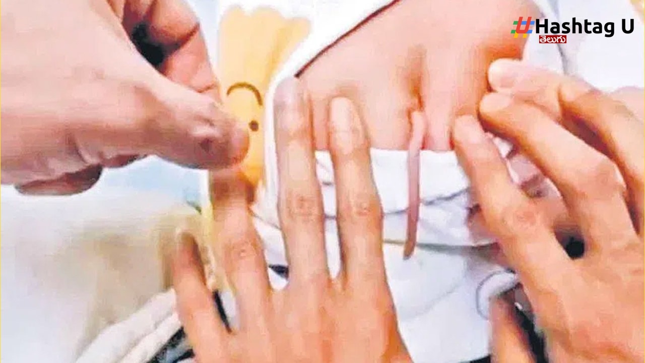 Child Born With Tail