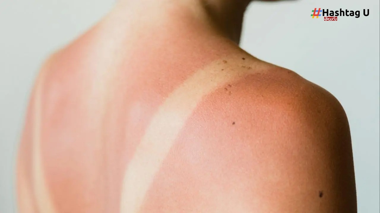 Sun Tan Tips