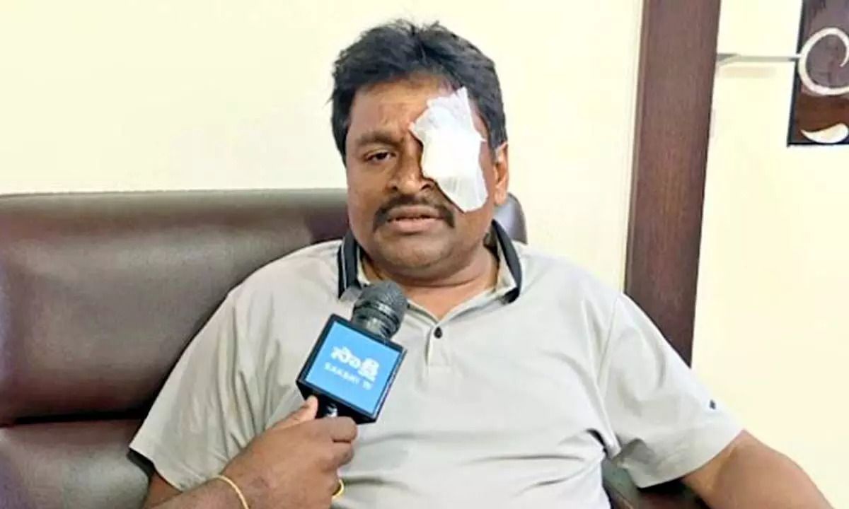 CM Jagan Attack