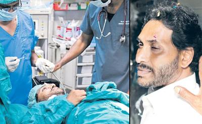 CM Jagan Attack