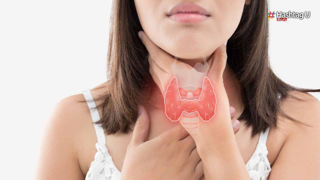 Thyroid Patients