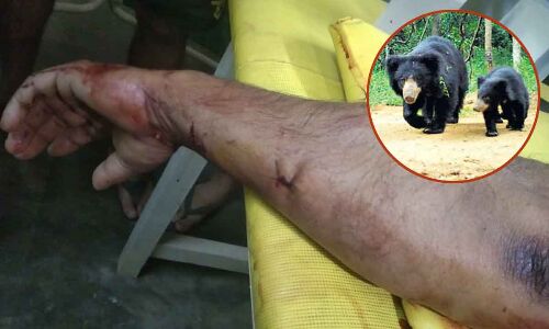 Bear Attack