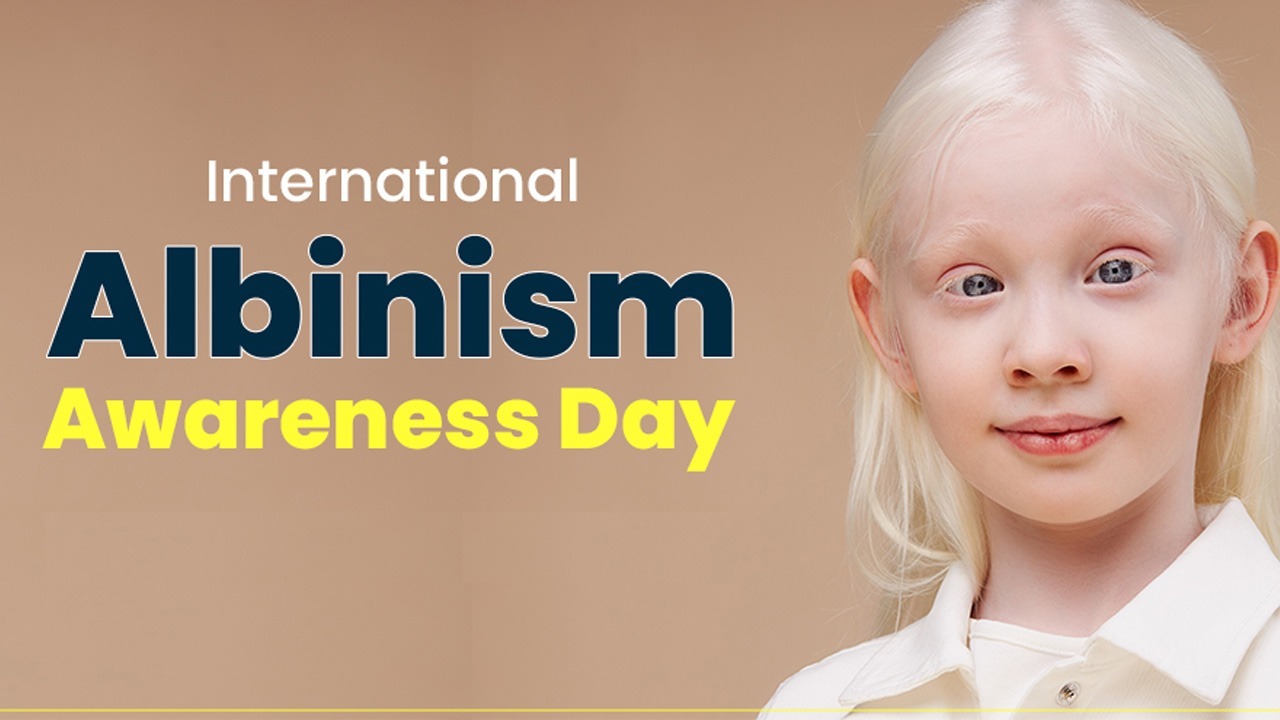 International Albinism Awareness Day