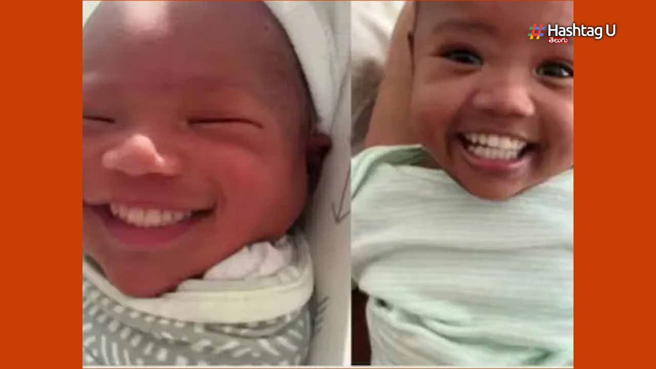 Baby Born With Teeth