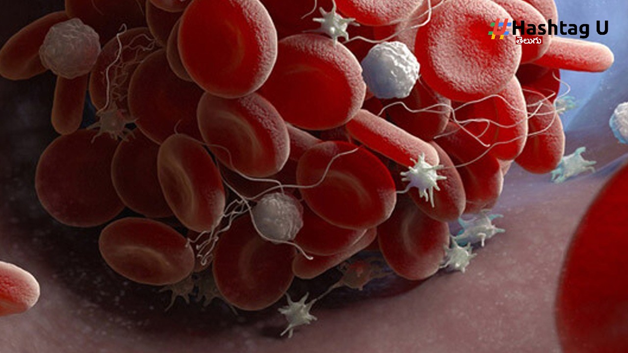 Dengue (3)