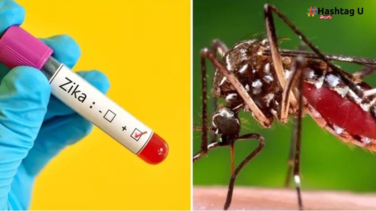 Zika Virus