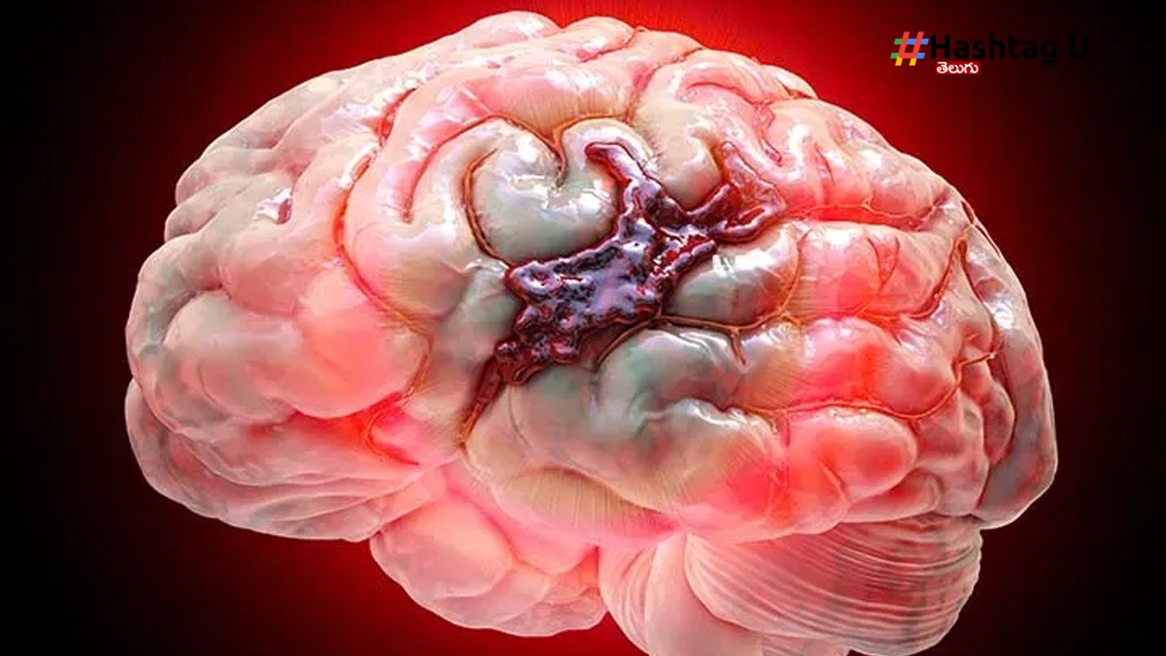 Brain (1)