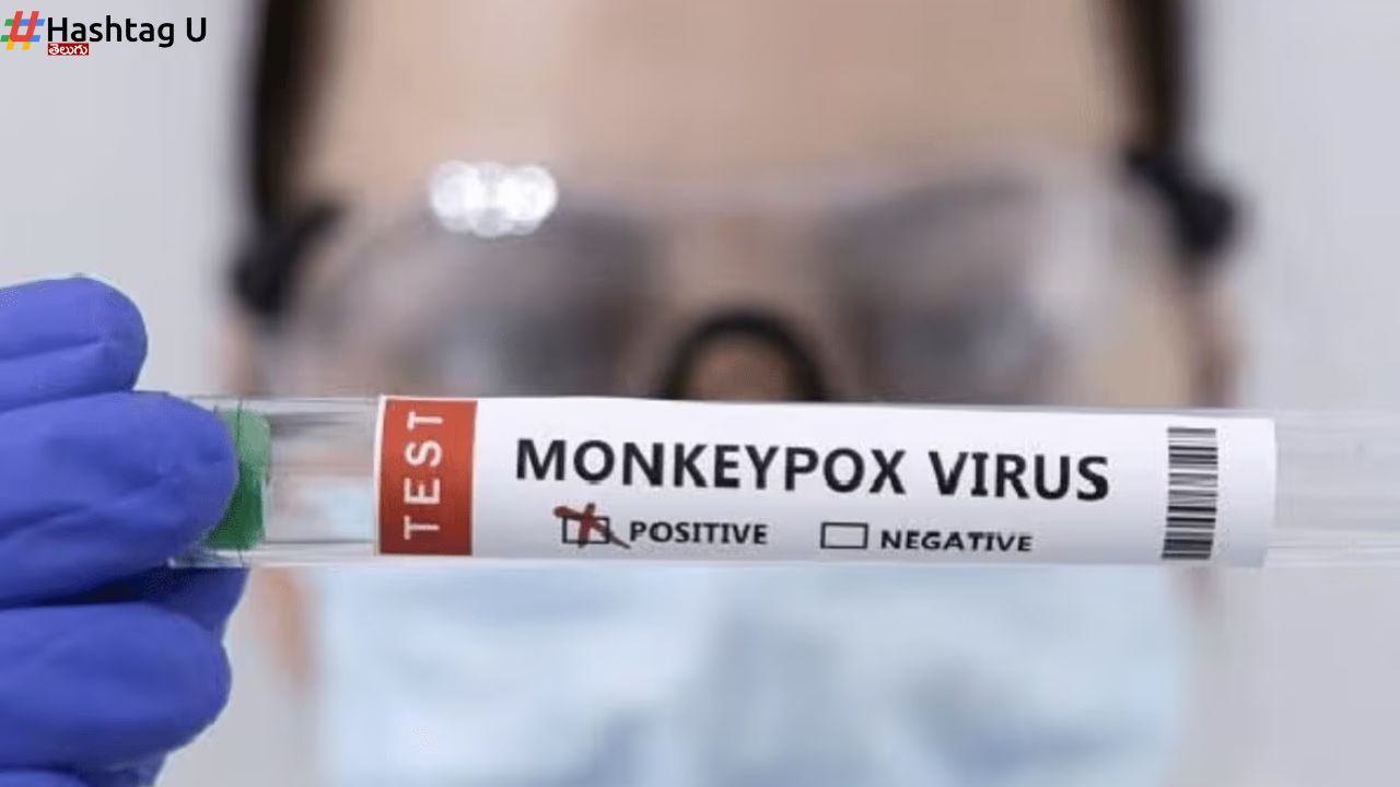 Second Mpox Case