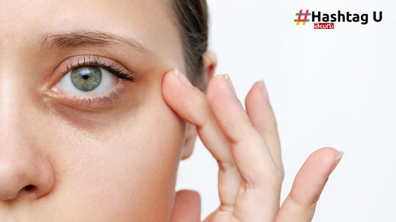 Dark Circles (1)