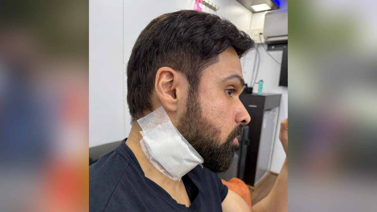 Emraan Hashmi Injured