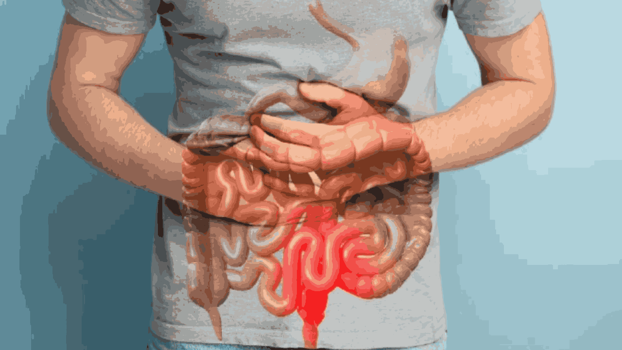 Colon Cancer: పెద్దప్రేగు క్యాన్సర్ ప్రారంభ సంకేతాలివే.. ఈ సమస్యకు కారణాలెంటో తెలుసా..? Colon Cancer