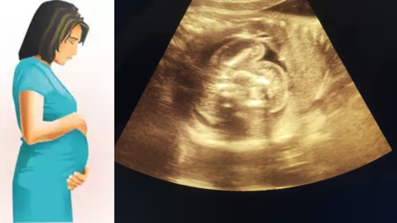 Fetus In Fetu In Pregnant Woman Maharashtra Doctors