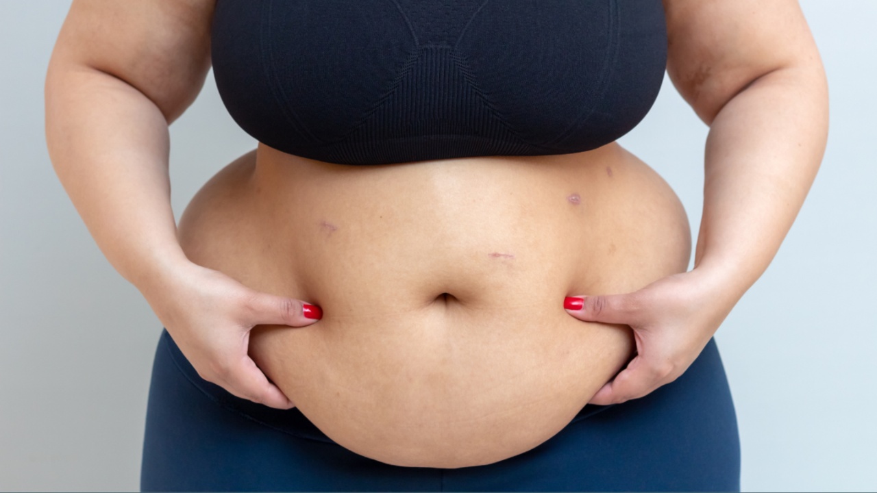 Belly Fat