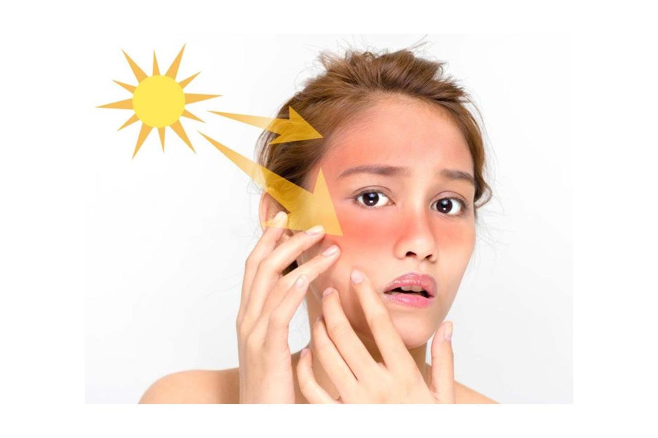 Skin Tanning