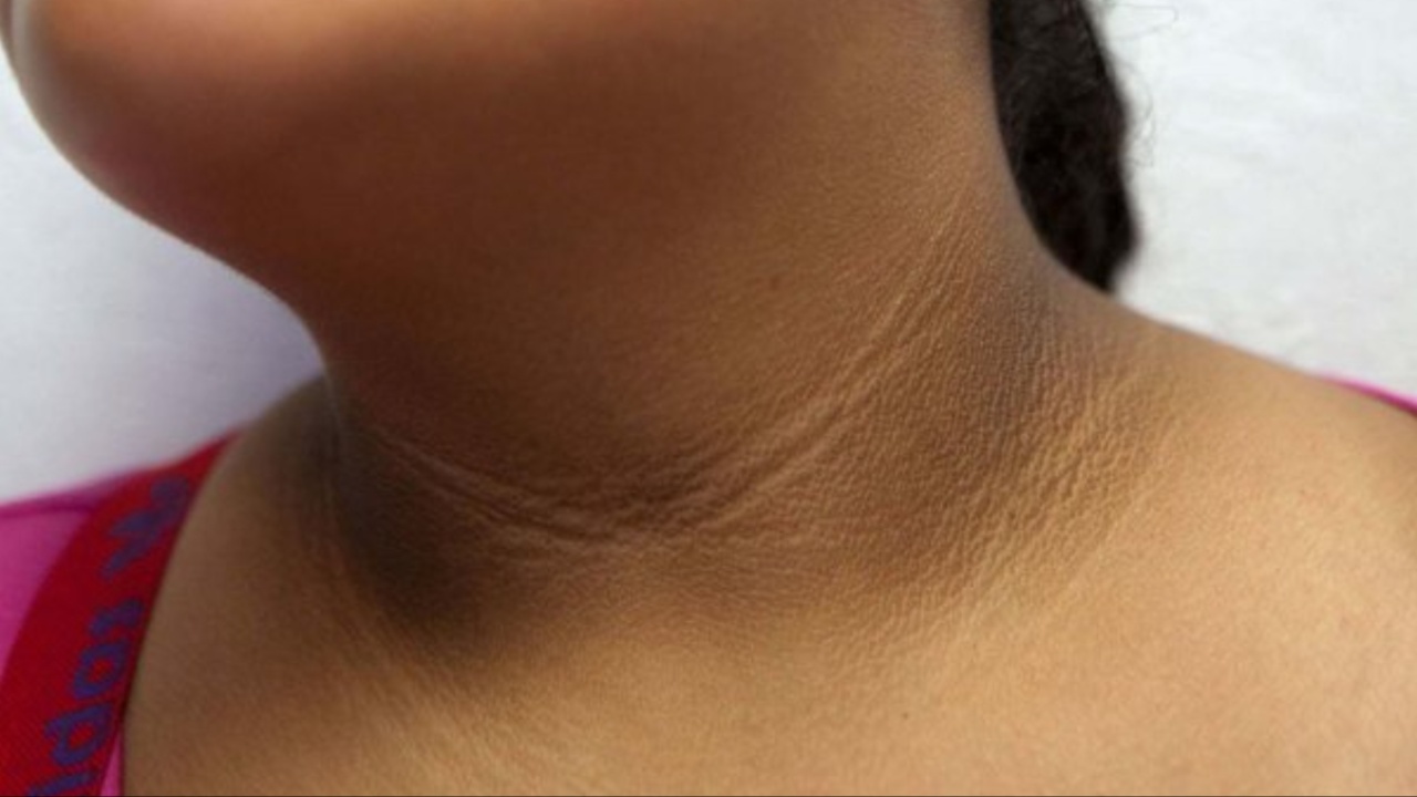 Black Neck