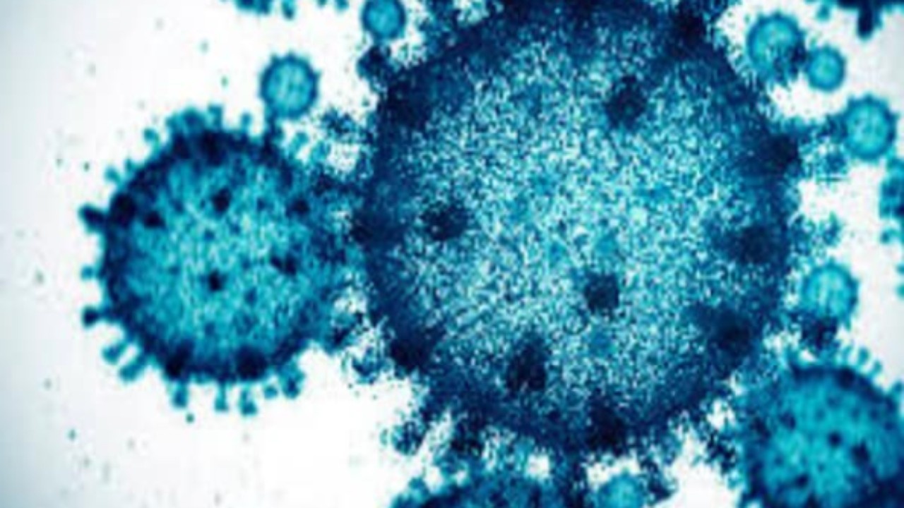 Russia Mystery Virus
