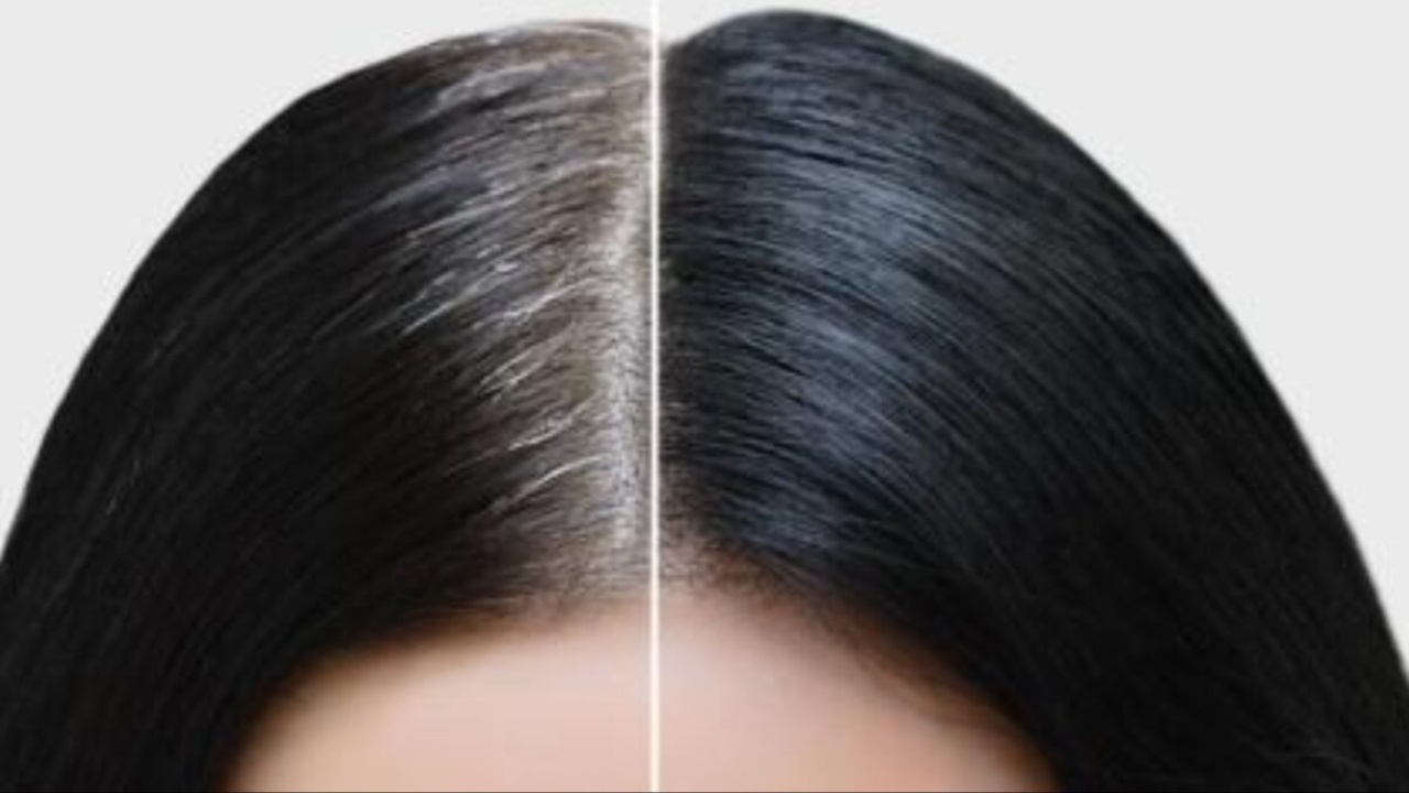 White Hair