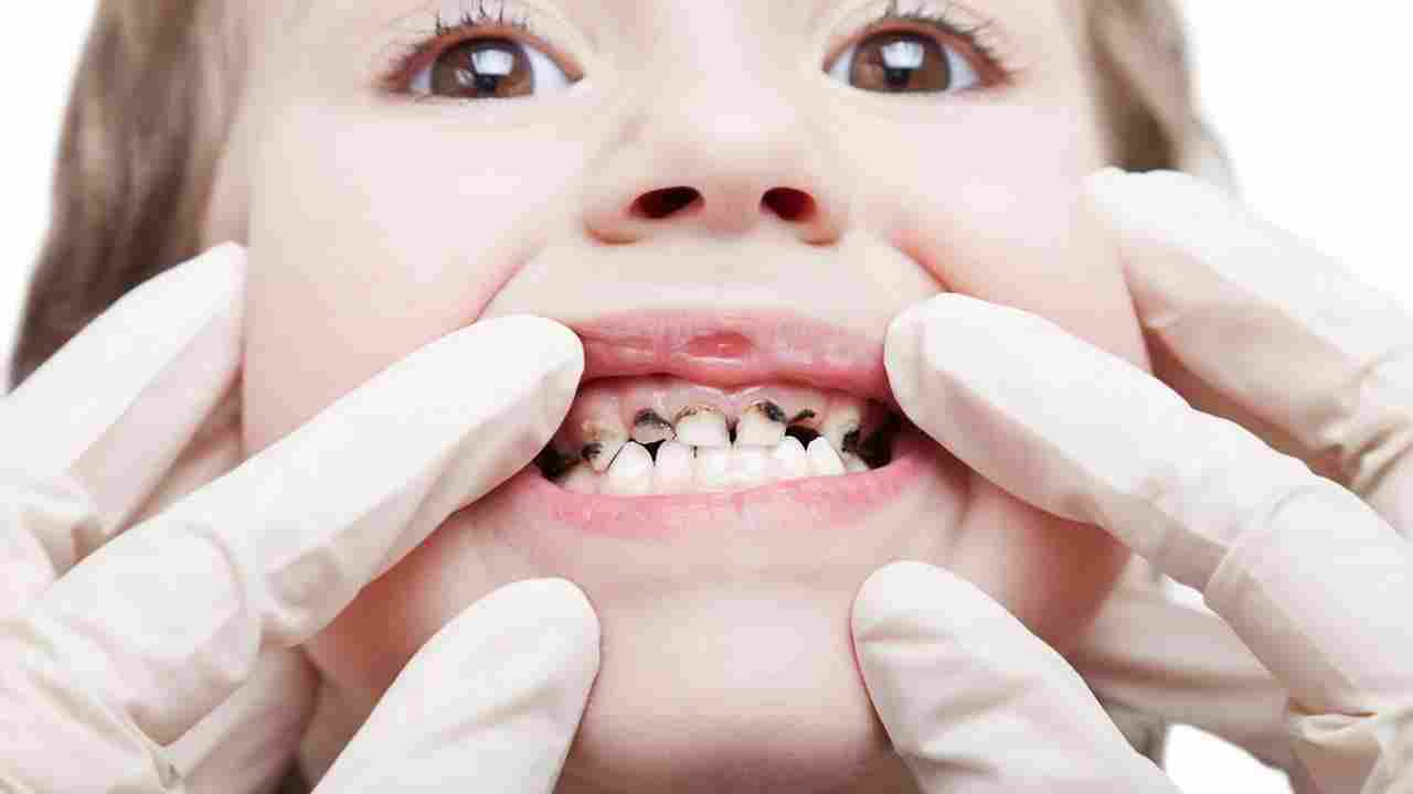 Cavities