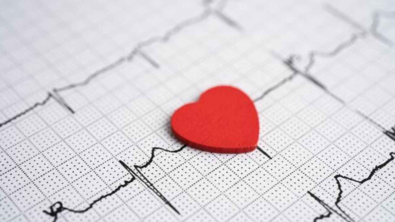 Heart attack